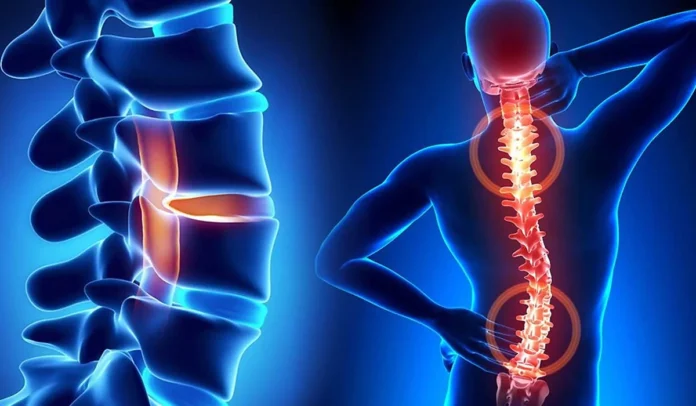 Spinal Wellness: Explore the Best Neuro Spine Surgeon in Mumbai